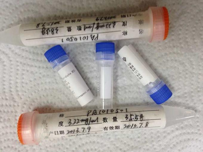 Rendimiento de los antígenos recombinantes de la enfermedad infecciosa de IgG HRP alto