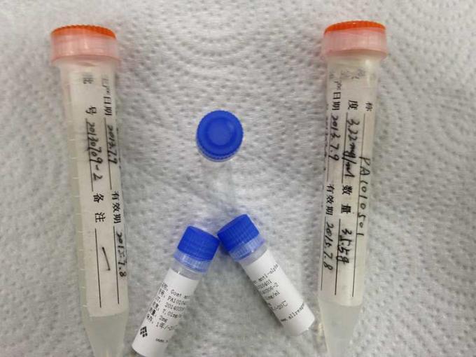 Droga anti del anticuerpo de HBcAg Mab Monoclone del ratón del abuso para la fabricación del IVD