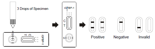 El flujo lateral Immunochromatographic prueba el casete rápido de la prueba de AllTest iGFBP-1 en descarga vaginal