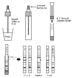 Análisis laterales de Immunochromatographic del flujo de la varilla graduada rápida de la prueba del antígeno de H.Pylori