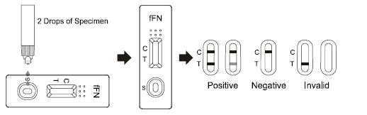 Casete rápido fetal de la prueba de Fibronectin, equipo de la prueba de droga del Rapid Response 25t