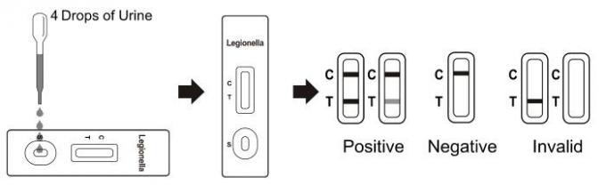 Casete rápido de la prueba del pneumophila de Legionella (orina)