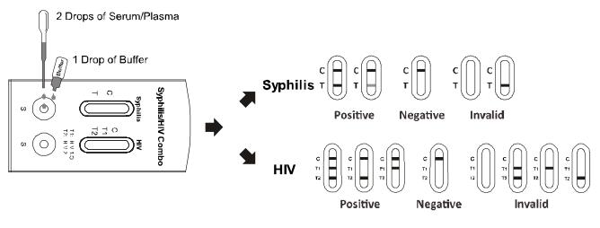 Enfermedad infecciosa de los equipos rápidos combinados de la prueba de la sífilis/VIH 1.2.O de AllTest