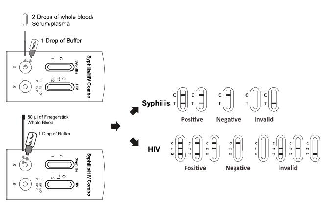 Sangre entera de Syphilis/HIV 1.2.O del casete rápido combinado de alta calidad de la prueba/suero/plasma