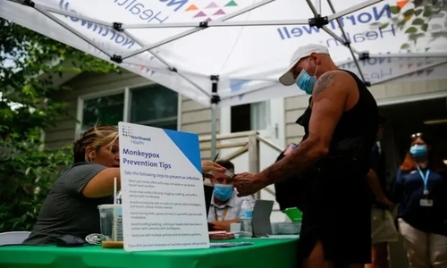 Latest company news about Respuesta inactiva a las agencias de la salud de los E.E.U.U. de las exposiciones de Monkeypox como “cansadas, con exceso de trabajo”