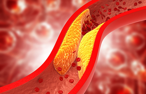Latest company news about Decodificar el colesterol: el camino hacia un cuerpo sano
