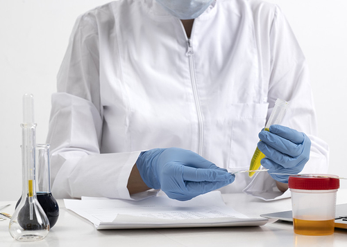 Latest company news about ¿Qué puede revelar la orina acerca de su salud?
