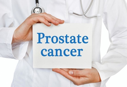 Últimas noticias de la empresa sobre Cáncer de próstata: un problema cada vez mayor para la salud de los hombres en todo el mundo