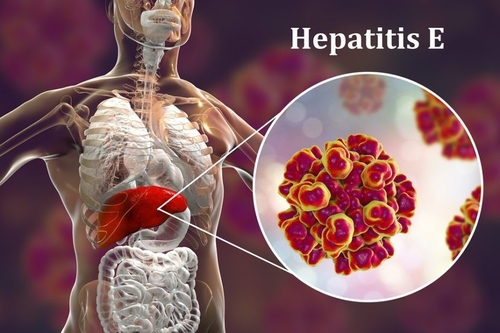 Latest company news about Amenaza viral para la reproducción: los peligros ocultos de la hepatitis E