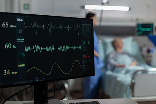 Últimos blogs de la empresa sobre Comprender la fibrilación auricular